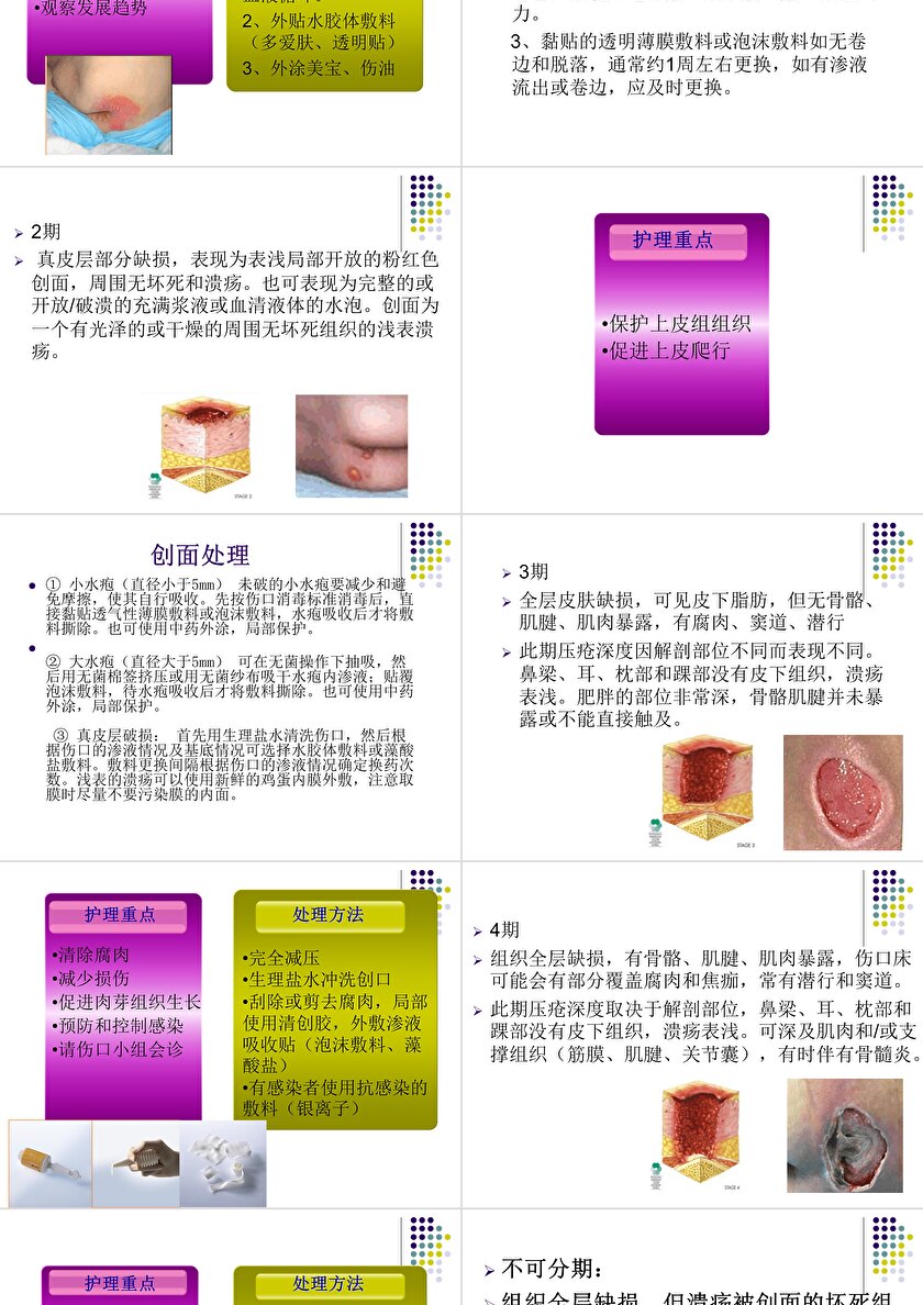 压疮的分期及临床表现最新版