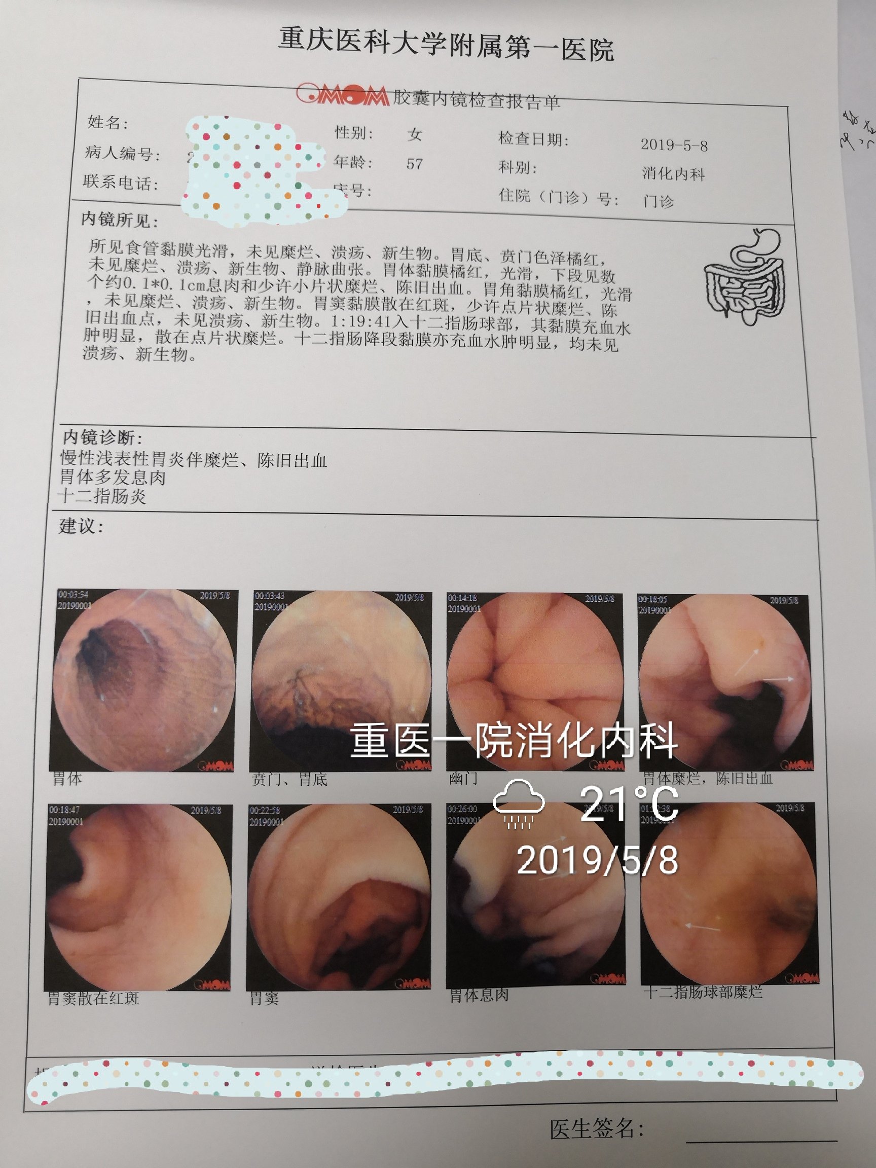 最新胃镜检查技术，不插管，费用多少？